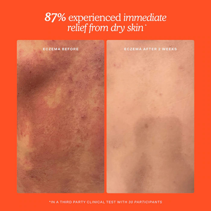 SOS Daily Hypochlorous Acid Spray for Breakouts & Redness - Tower 28