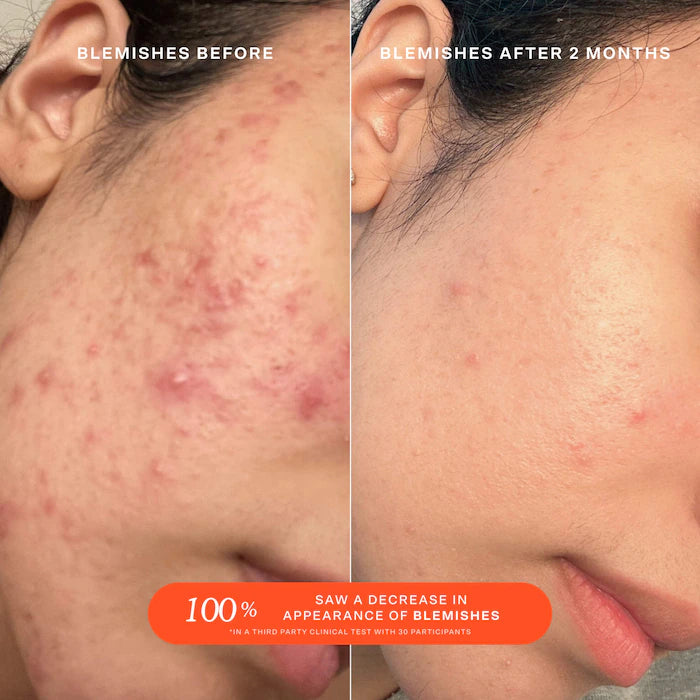 Cozy & Clean Makeup Value Set - Sephora Favorites